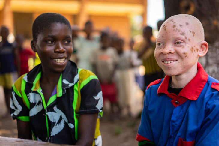 Breaking barriers for education of children with albinism